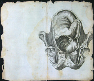 Grafika - Oceloryt - Rok 1778 - Poloha plodu - Fig. 10 (174) (Zpráva o kumštu babském)