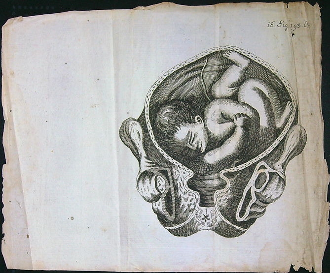 Grafika - Oceloryt - Rok 1778 - Poloha plodu - Fig. 16 (193) (Zpráva o kumštu babském)