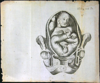 Grafika - Oceloryt - Rok 1778 - Poloha plodu - Fig. 23 (212) (Zpráva o kumštu babském)