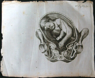 Grafika - Oceloryt - Rok 1778 - Poloha plodu - Fig. 24 (219) (Zpráva o kumštu babském)