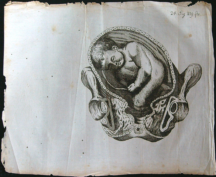 Grafika - Oceloryt - Rok 1778 - Poloha plodu - Fig. 24 (219) (Zpráva o kumštu babském)