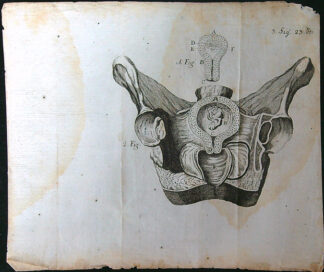 Grafika - Oceloryt - Rok 1778 - Poloha plodu - Fig. 3 (23) (Zpráva o kumštu babském)