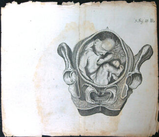 Grafika - Oceloryt - Rok 1778 - Poloha plodu - Fig. 5 (23) (Zpráva o kumštu babském)